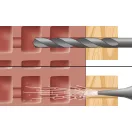 Celo 9HD10100MFRST "MFR" TOKRÖGZÍTŐ DÜBEL+SÜLLYESZTETT FEJŰ CSAVAR 10*100 TÜZIHORGANYZOTT 50db/cs